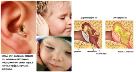 Причины интенсивного зуда в ушах